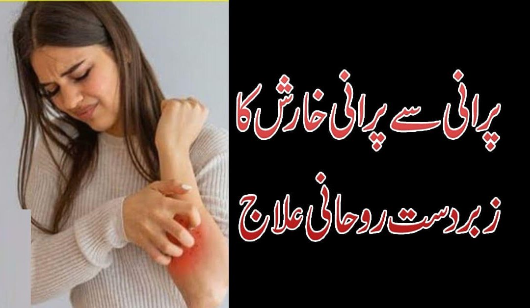 Kharish (Itch) Ka Rohani Ilaj