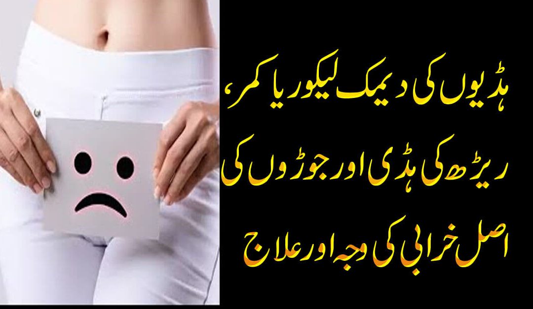 Likoriya Ka best Ilaj